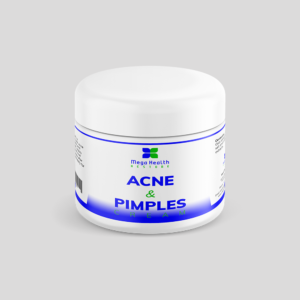 Acne and Pimples Cream